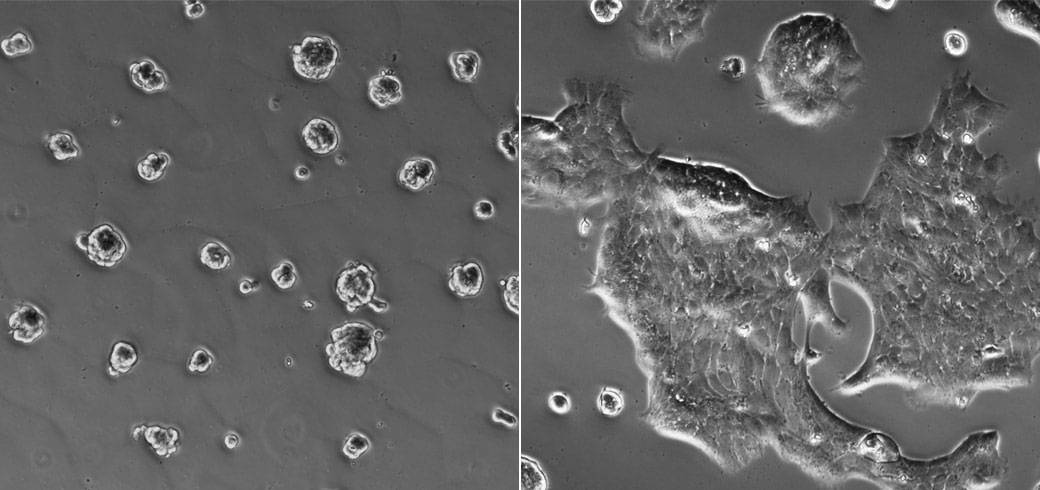 Images of cells that lead to breast-cancer progression in laboratory cultures