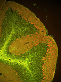 Cerebellum