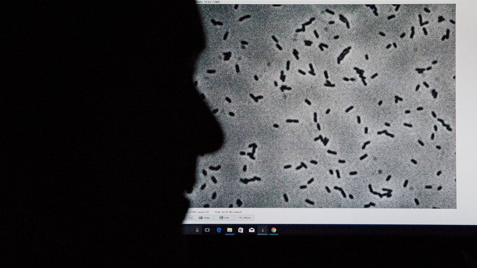 Details from slide of E Coli experiment