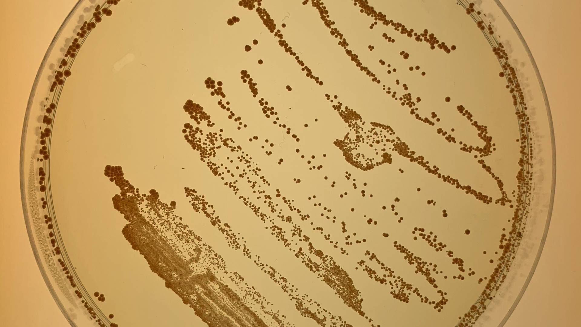 Closeup of bacteria in a petri dish