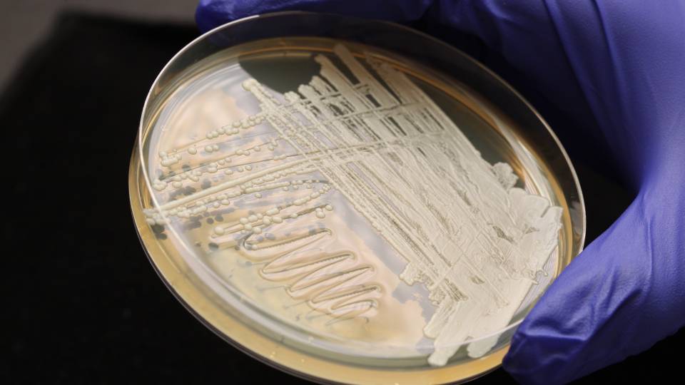 petri dish with yeast culture