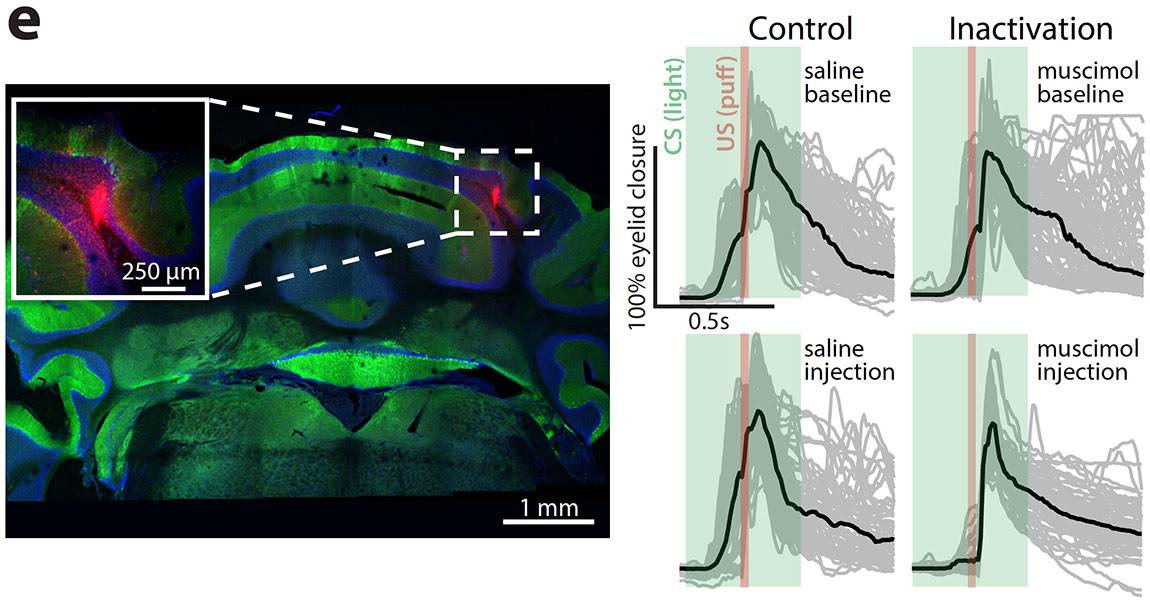 images of individual granule neurons