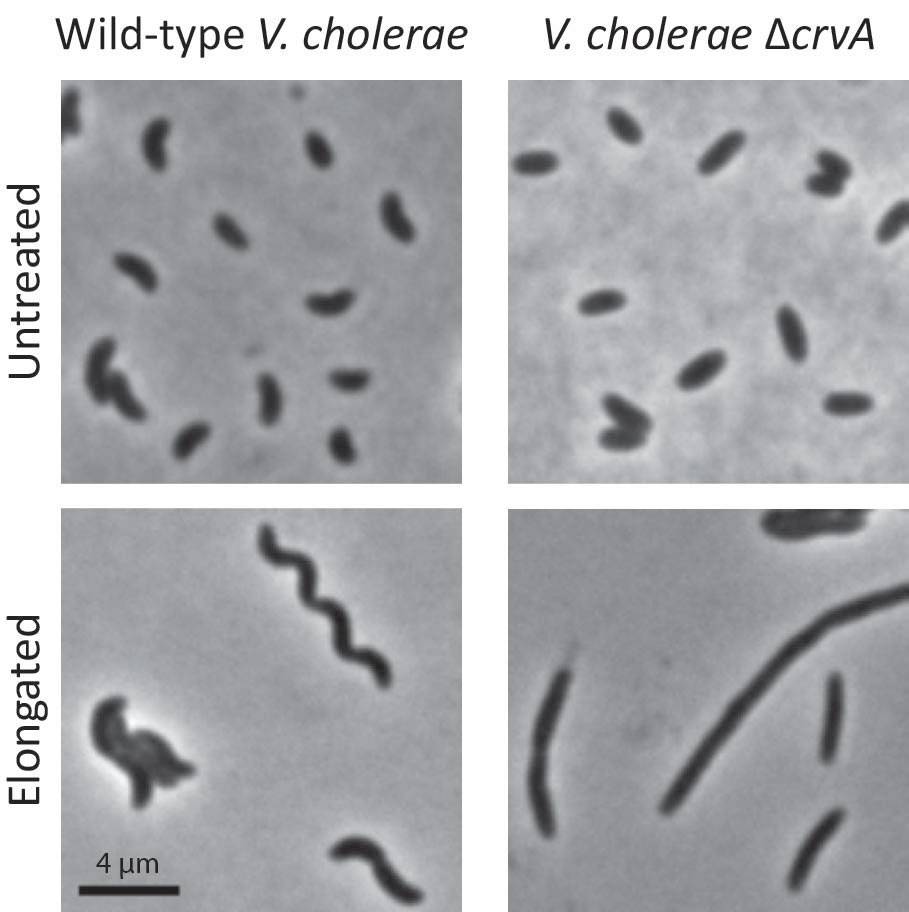 In experiments, the researchers found that curved <i>V. cholerae</i> cells (left column) could more easily move through a thick gel. Straight rod-shaped <i>V. cholerae</i> that had the protein CrvA suppressed (right column) could not infect a host as efficiently. The researchers elongated the wild-type and CrvA-suppressed cells (bottom row) to accentuate the difference in shape the protein produces. <i>(Image by Thomas Bartlett, Department of Molecular Biology)</i>  